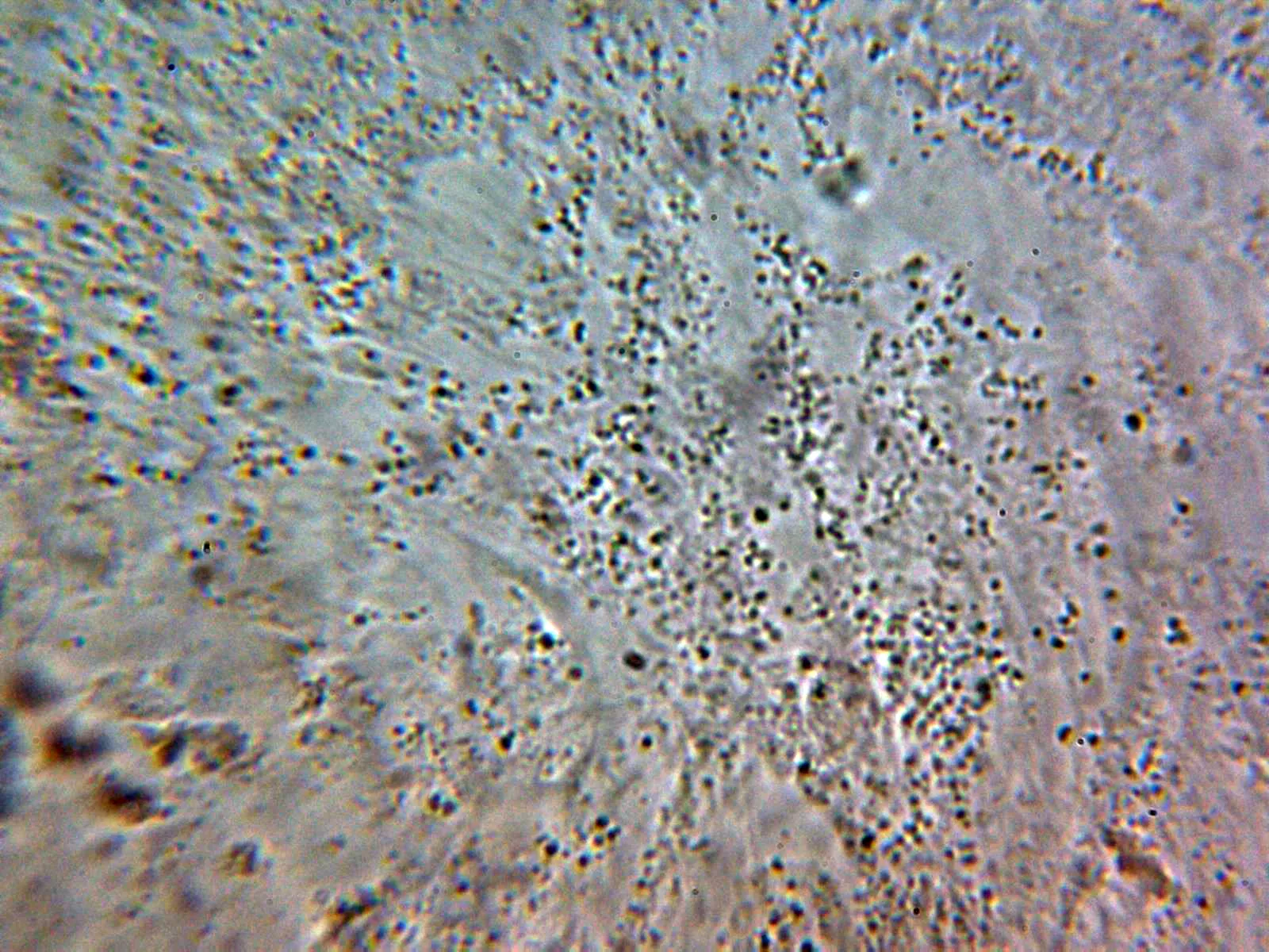 Microscopía de Mycena mucor - 12 - Cutícula quizás